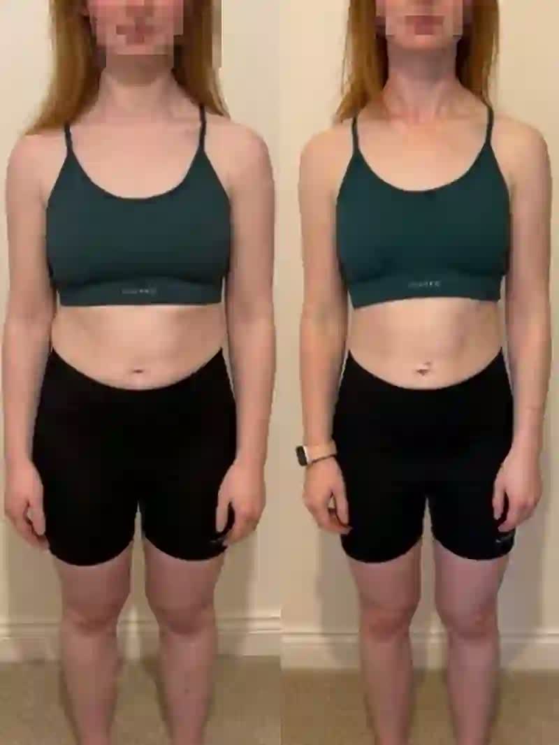 Chiara V. — Forevr Her transformation
